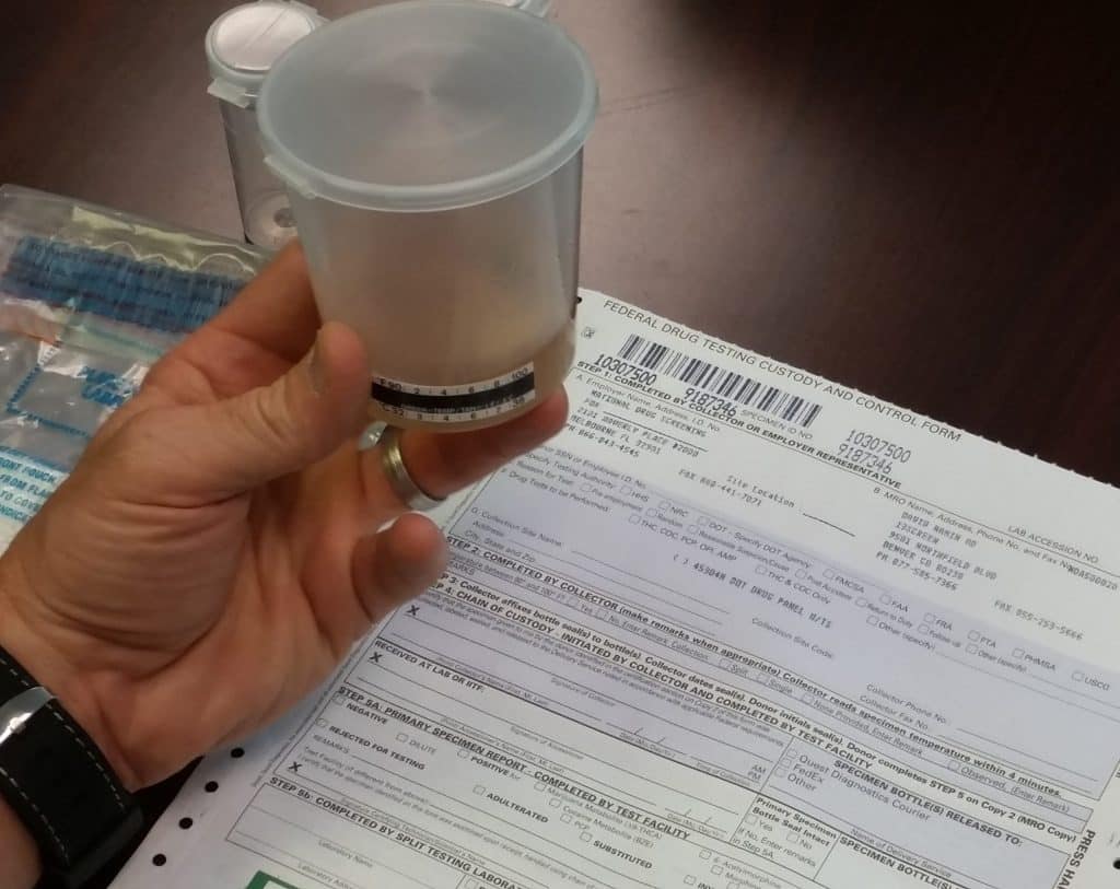 Man holding a specimen cup for CCF Form